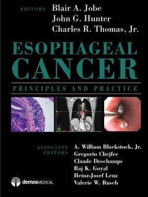 cover image of Esophageal Cancer